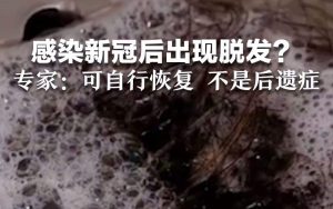 专家说感染新冠后脱发比较普遍（感染新冠会脱发严重吗）看最鲜网，看新知识-提供各类互联网项目，互联网副业，职场技能课程，股票期货投资, 校园课程，升学考试等有价值的知识看最鲜网，看新知识