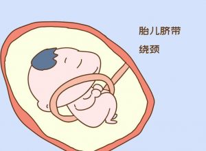 脐带绕颈和睡姿有关吗（孕妇睡姿会导致脐带绕颈吗）看最鲜网，看新知识-提供各类互联网项目，互联网副业，职场技能课程，股票期货投资, 校园课程，升学考试等有价值的知识看最鲜网，看新知识